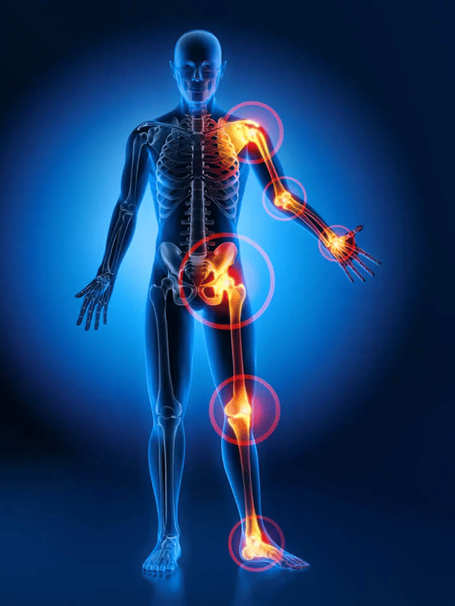 Reclaim Your Bone Health 5 Natural Methods to Reverse Osteoporosis